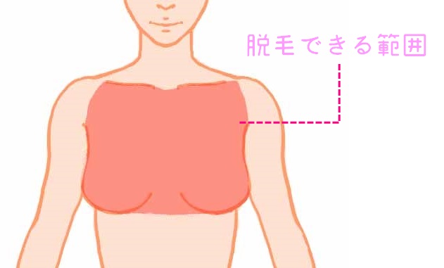 脱毛　胸　範囲　イラスト 図解